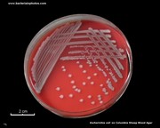 columbia sheep blood agar